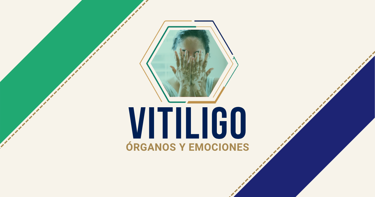 Vitiligo: origen emocional según Biodesprogramación
