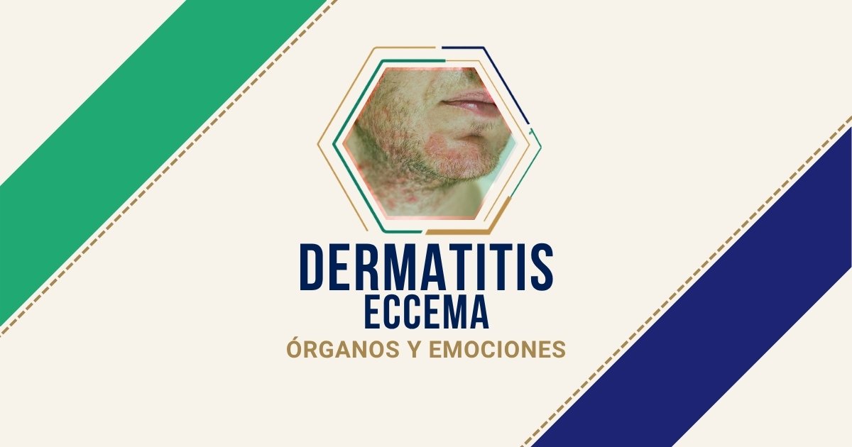 Dermatitis / Eccema: origen emocional según Biodesprogramación